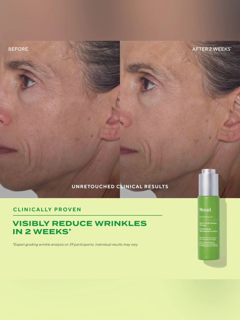 🌿 Murad Retinol Youth Renewal Oil Drops 1 oz Brand New In Box